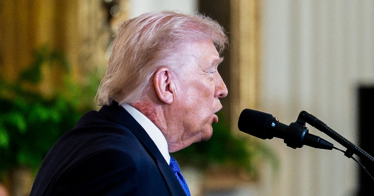 Donald Trump's Health: New Speculations After Red Mark on Neck